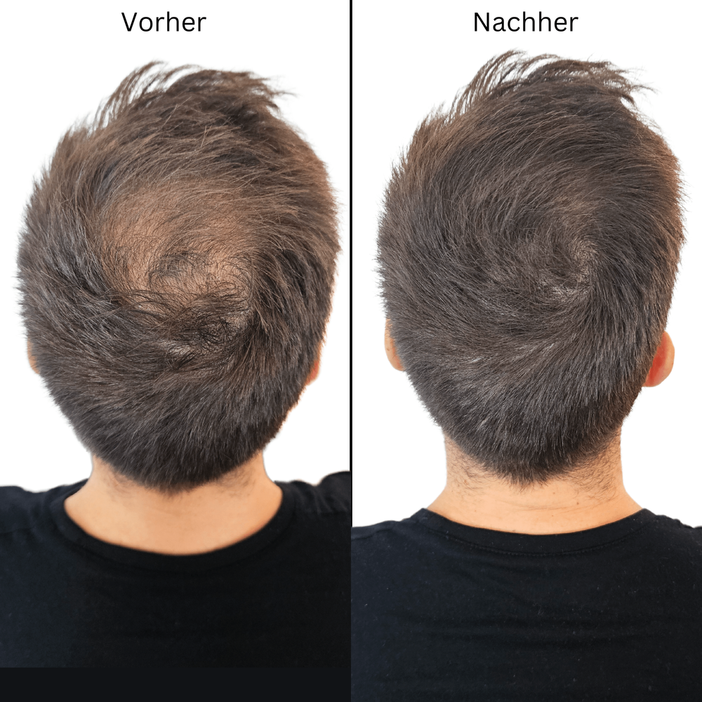 Fidentia Haarauffüller Spray 200ml - neu mit verbesserter Formel