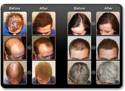 Mane Haarauffüller Haarverdichter Spray zur Haarverdichtung 100ml
