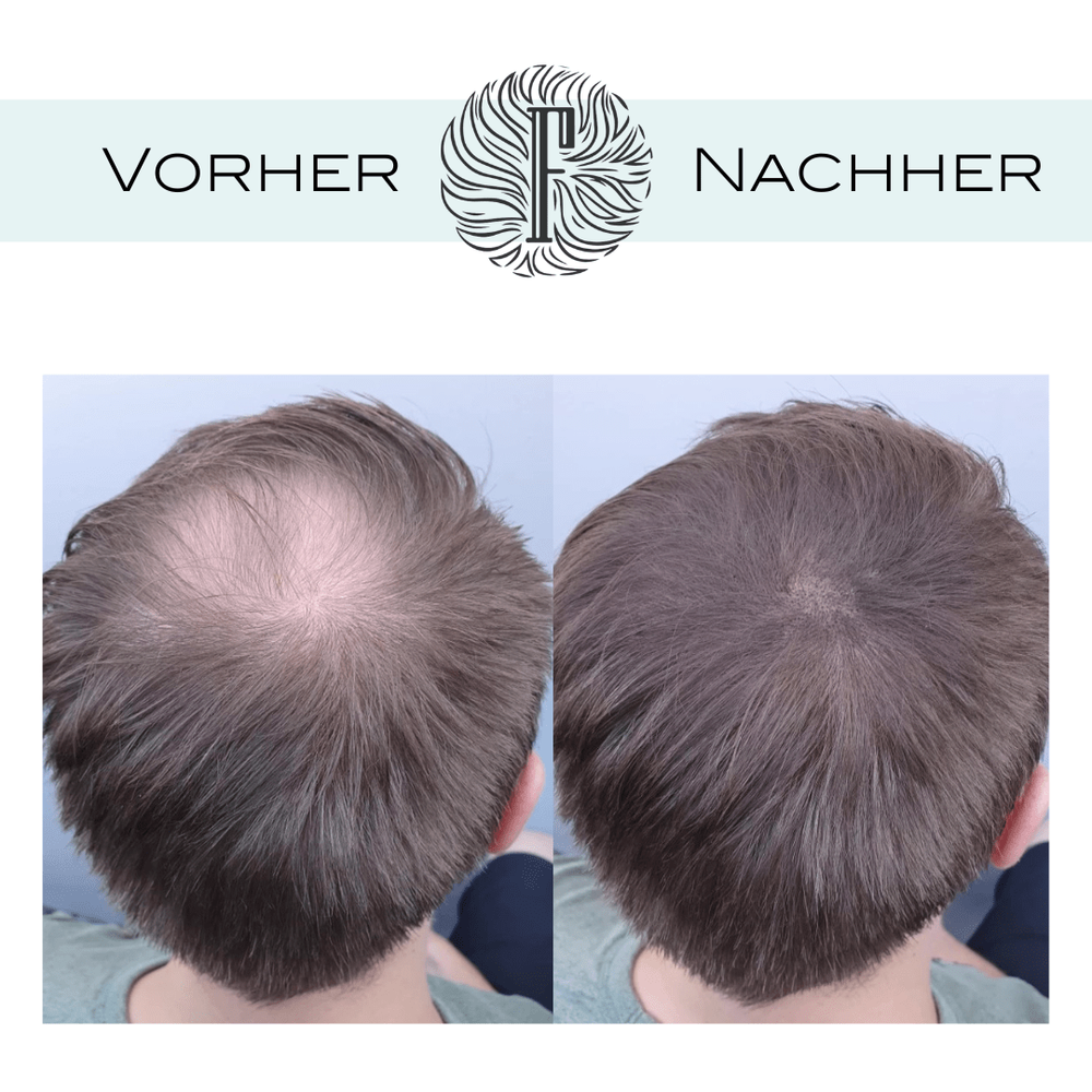 Fidentia Haar Concealer Shader Karton